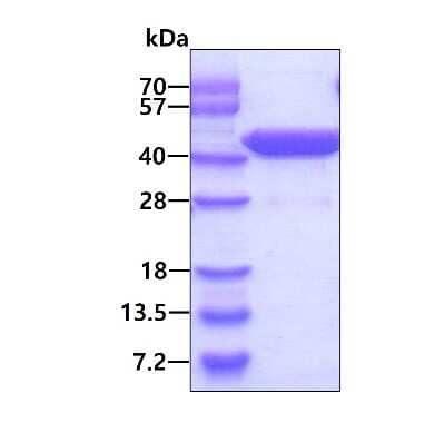 SDS-PAGE: Recombinant Human ZADH1 His Protein [NBP1-99021]